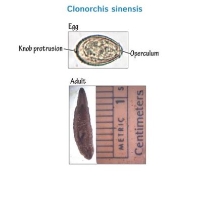  Clonorchis Sinensis: A Tiny Trematode That Thrives in Bile!