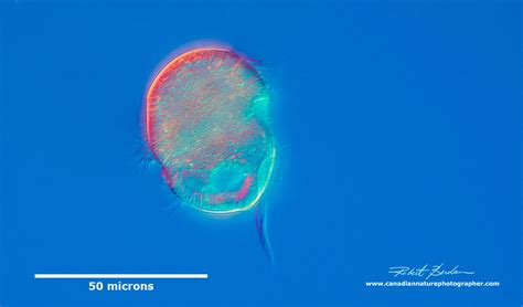  Urocentrum! Một Ciliate Bất Thường Sở Hữu Ánh Trắng Bóng Bẩy Và Những Lông Rậm Rạp Tạo Nên Sự Lộng Lẫy Cho Thế Giới Vi Sinh Vật